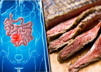 Thịt đỏ làm tăng nguy cơ ung thư ruột