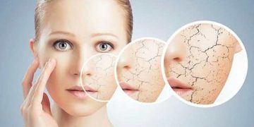 Chăm sóc da khô 1