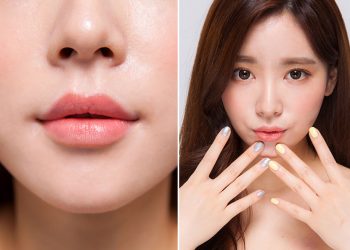 Phẫu thuật thẩm mỹ nâng khóe môi - 01