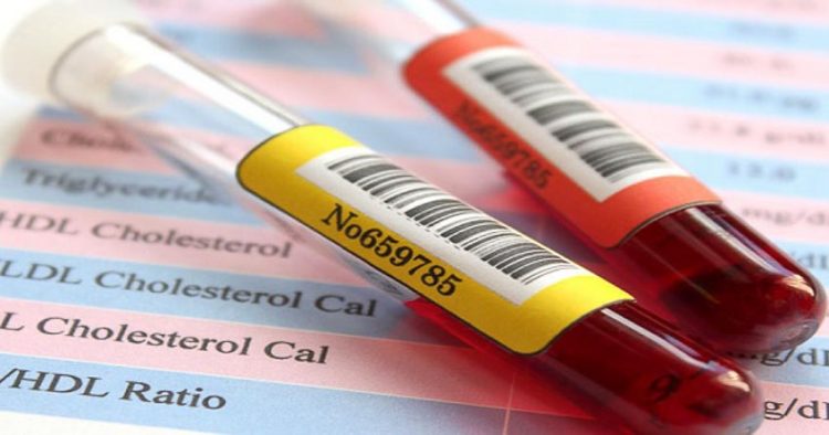 Chỉ số cholesterol không phải là thước đo tuyệt đối
