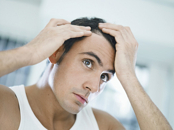Giải pháp cứu nguy cho nam giới bị tóc rụng 4