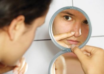 Điều trị mụn trứng cá ở người trưởng thành 1