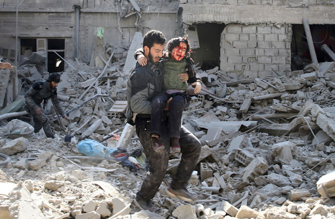 Trẻ em bị thương trong một vụ không kích ở Đông Ghouta. Ảnh: Reuters.