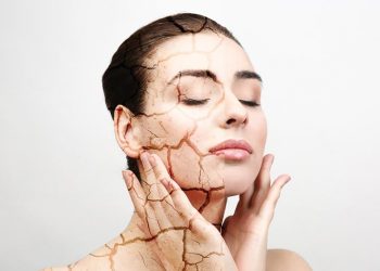 Da quá khô, làm sao để duy trì độ ẩm? 1