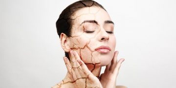 Da quá khô, làm sao để duy trì độ ẩm? 1