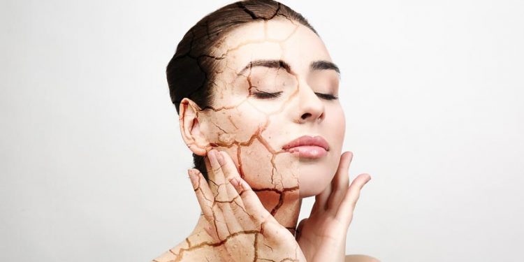 Da quá khô, làm sao để duy trì độ ẩm? 1