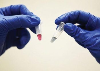 Phát hiện ung thư chỉ trong 10 phút, chính xác 90% và rẻ không ngờ