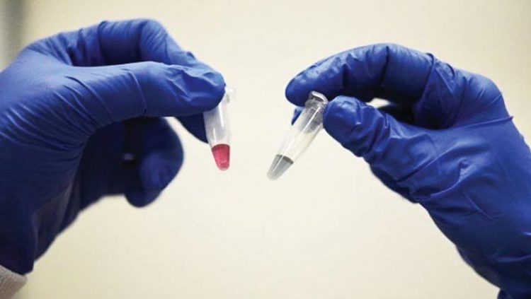 Phát hiện ung thư chỉ trong 10 phút, chính xác 90% và rẻ không ngờ