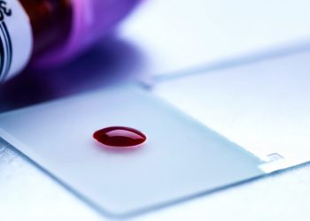 Thiết bị đột phá giúp phát hiện ung thư chỉ qua một giọt máu