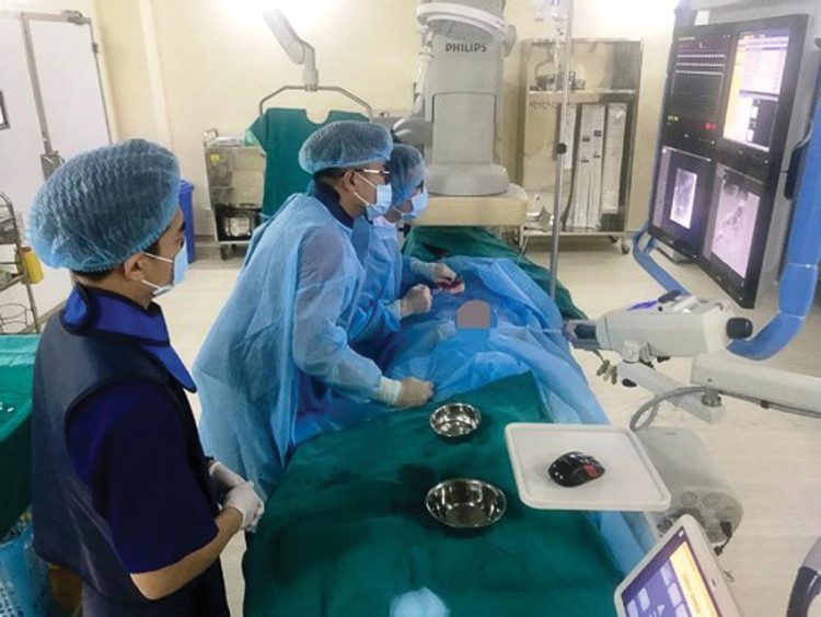 Loại bỏ u gan không cần phẫu thuật, đốt u bằng sóng viba