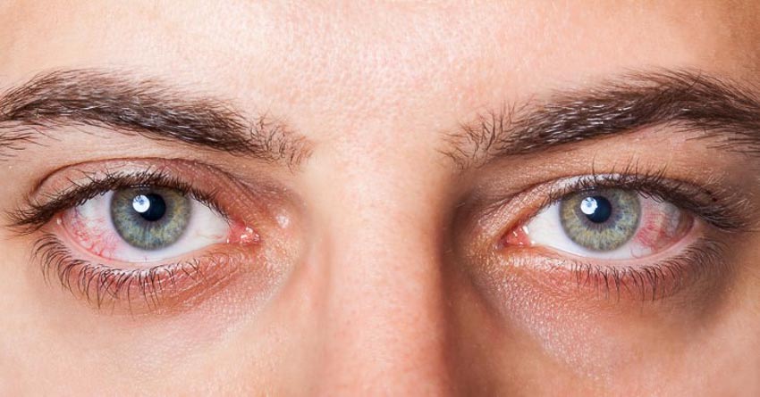 Đôi mắt của bạn nói rất nhiều về sức khỏe của bạn