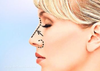 Chiếc mũi nói gì về cá tính của bạn