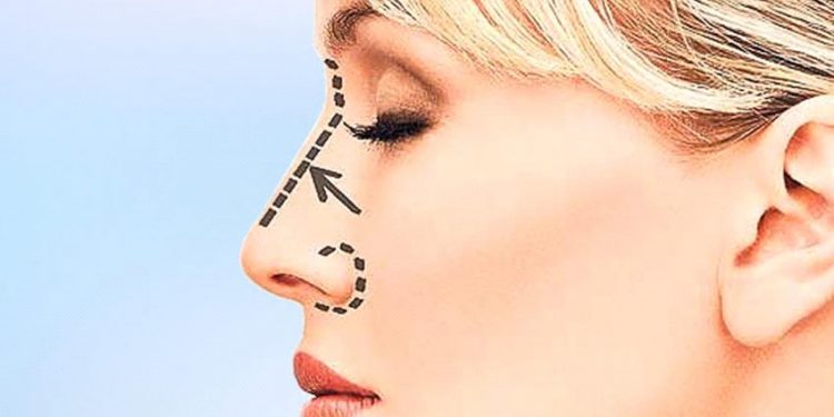 Chiếc mũi nói gì về cá tính của bạn