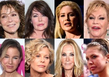 Những ngôi sao điện ảnh tự hủy hoại sự nghiệp vì phẫu thuật thẩm mỹ