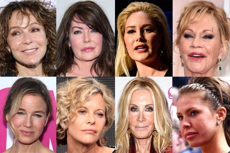 Những ngôi sao điện ảnh tự hủy hoại sự nghiệp vì phẫu thuật thẩm mỹ