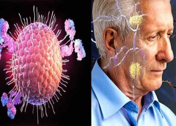 Lần theo nguồn gốc gây bệnh Alzheimer -3