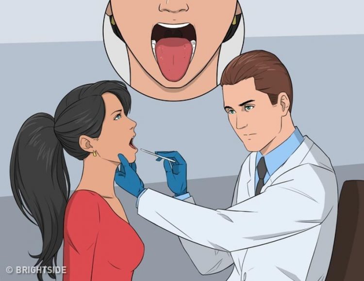 Hơi thở hôi nói gì về sức khỏe của chúng ta? - 12