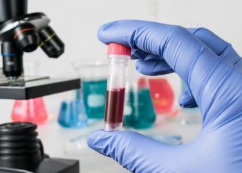 Xác định thêm một chủng virus HIV hoàn toàn mới