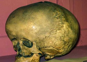 Một xác ướp kỳ lạ và những chiếc sọ bí ẩn - 3