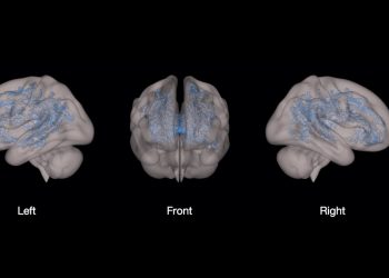 Hình ảnh chụp não bộ của hai đứa trẻ thường xuyên đọc sách và thường xuyên xem điện thoại