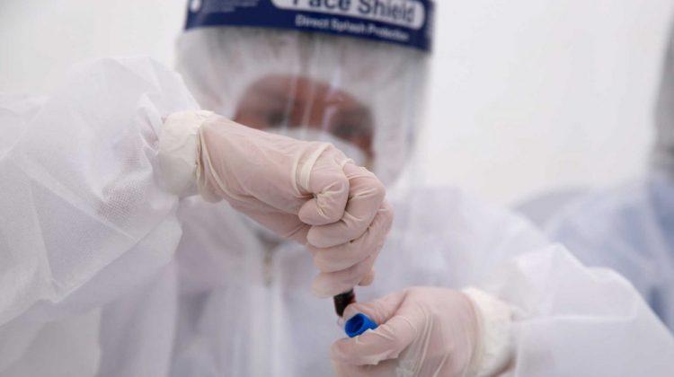 Bộ kit Genelyzer xét nghiệm nhanh đối với virus SARS-CoV-2 có thể ứng dụng rộng rãi