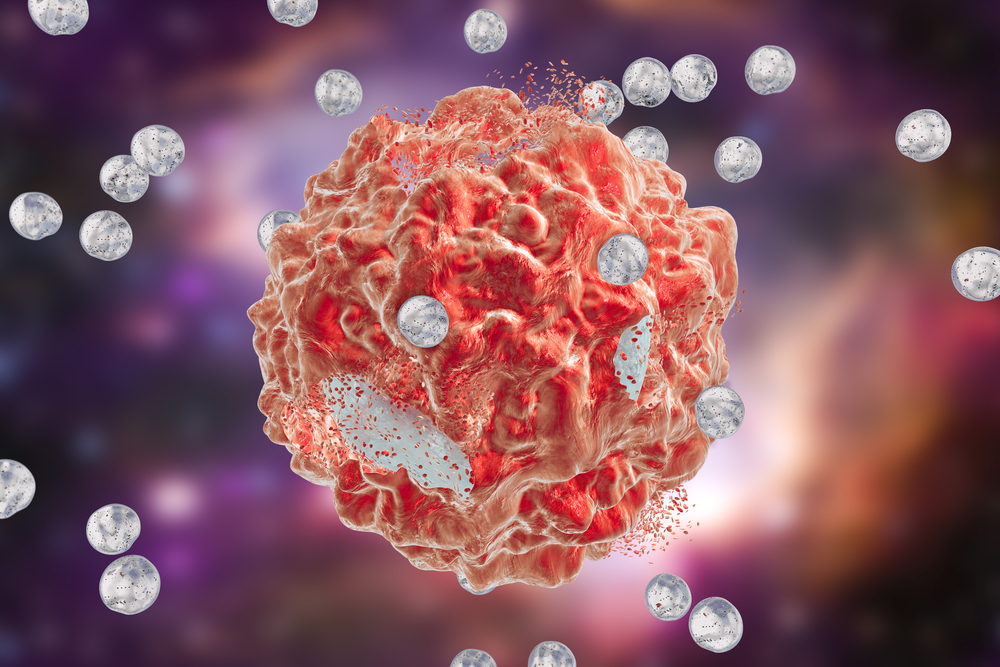 Tìm cách tốt nhất để áp dụng liệu pháp hạt nano cho điều trị ung thư - 2