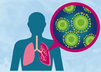 Nguyên nhân và triệu chứng của 6 bệnh viêm phổi thường gặp -1