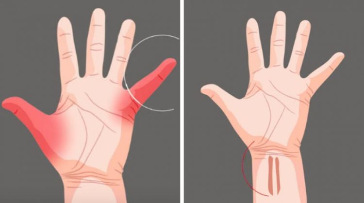 10 đặc điểm cơ thể hiếm thấy nơi con người -8