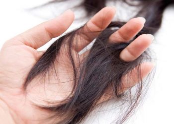 Nguyên nhân khiến mái tóc của phái đẹp rụng tả tơi -2