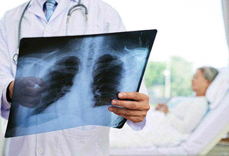 Những dấu hiệu cảnh báo sức khỏe sau 50 -4