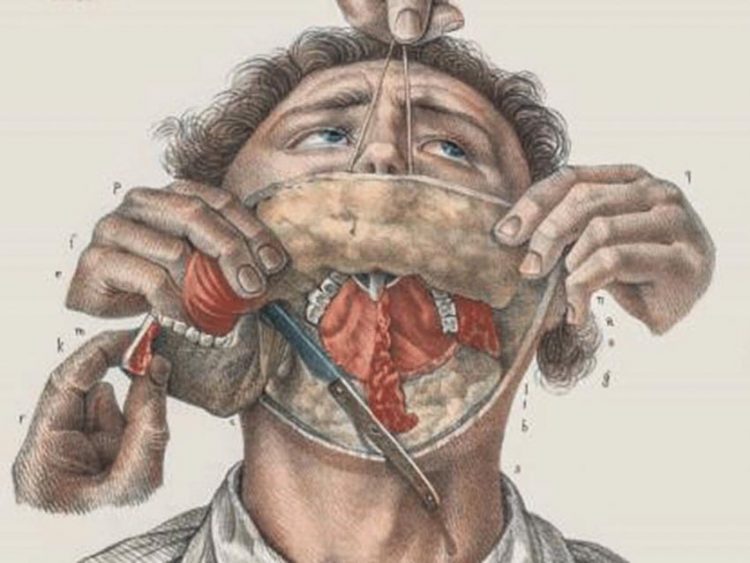 Chuyện hấp dẫn về những ca phẫu thuật đầu tiên trên thế giới -2