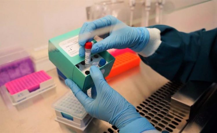 Vinmec phát triển thành công hai bộ Kit xét nghiệm SARS-CoV-2, gia tăng tốc độ xét nghiệm -1