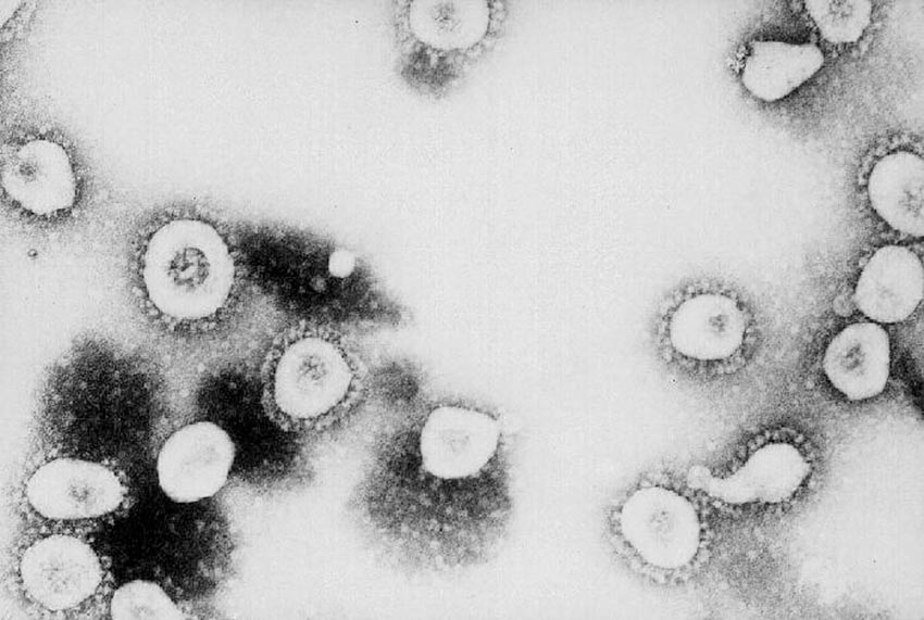 Virus Corona: Cơn dịch bệnh sẽ kết thúc ra sao? -1