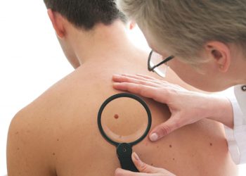 Phát hiện ‘thời điểm vàng’ ngăn chặn ung thư di căn