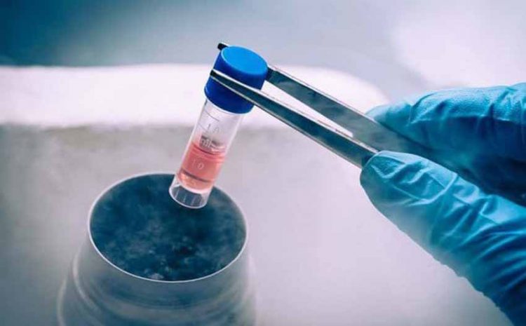 Tế bào gốc điều trị ung thư gan?