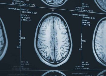 8 bí ẩn không được giải quyết của y học -2