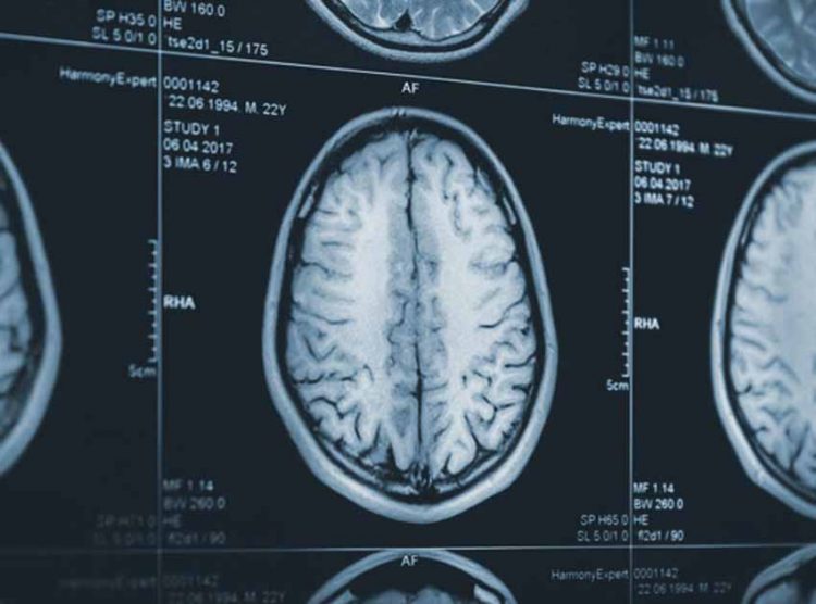 8 bí ẩn không được giải quyết của y học -2