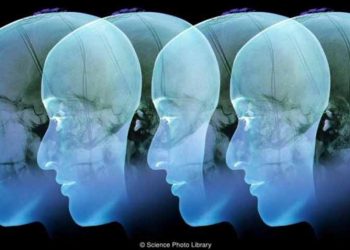 Mối liên quan giữa chứng nghiện ăn và não bộ - 1