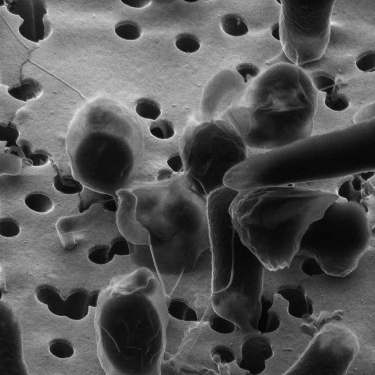 Vi khuẩn ăn thịt, sát thủ kiêm giữ gìn hoà bình - 3