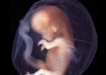 Những lần bệnh viện cấy lầm phôi thai