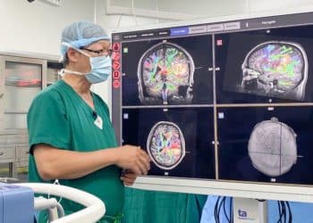 Bệnh viện Tâm Anh phẫu thuật não tỉnh thành công cho bệnh nhân xuất huyết não bằng robot AI - 1