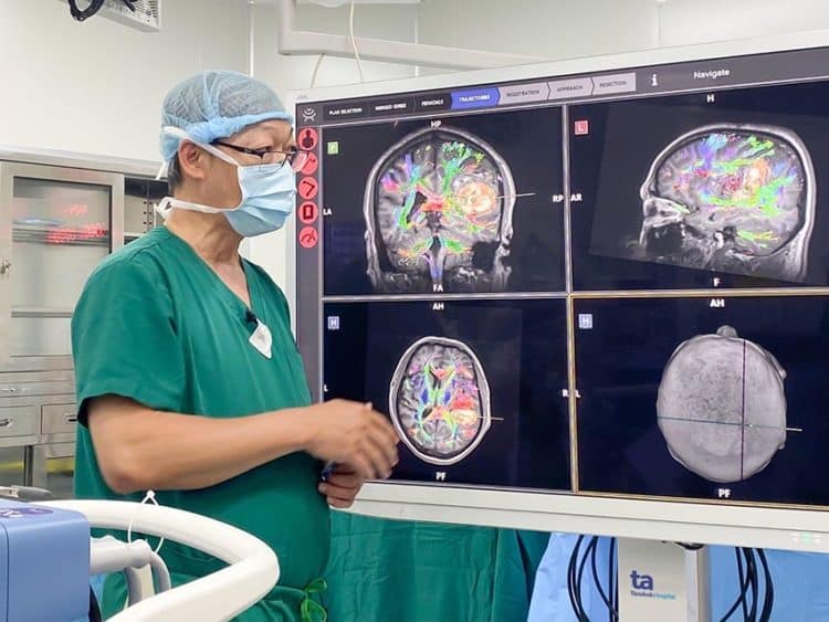 Bệnh viện Tâm Anh phẫu thuật não tỉnh thành công cho bệnh nhân xuất huyết não bằng robot AI - 1