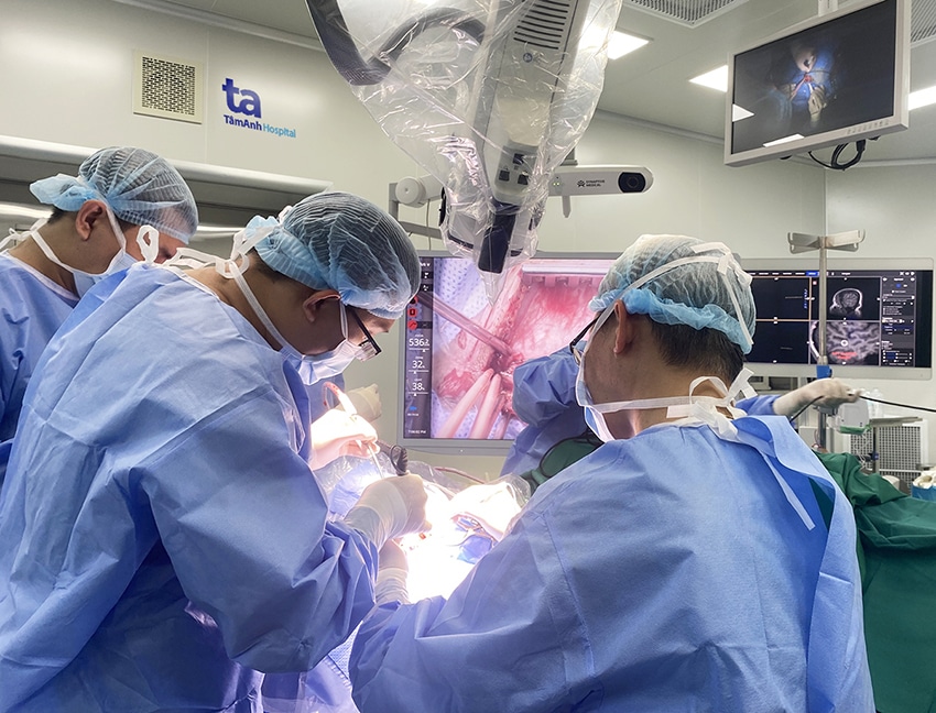 Bệnh viện Tâm Anh phẫu thuật não tỉnh thành công cho bệnh nhân xuất huyết não bằng robot AI - 3
