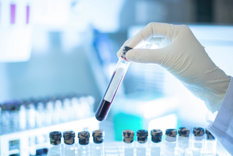 Xét nghiệm máu phát hiện sớm đa ung thư của Grail sắp được FDA phê chuẩn