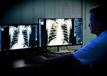 Chương trình Chống lao và Quỹ Toàn cầu mở rộng ứng dụng AI DrAid™ Lao Phổi - 2