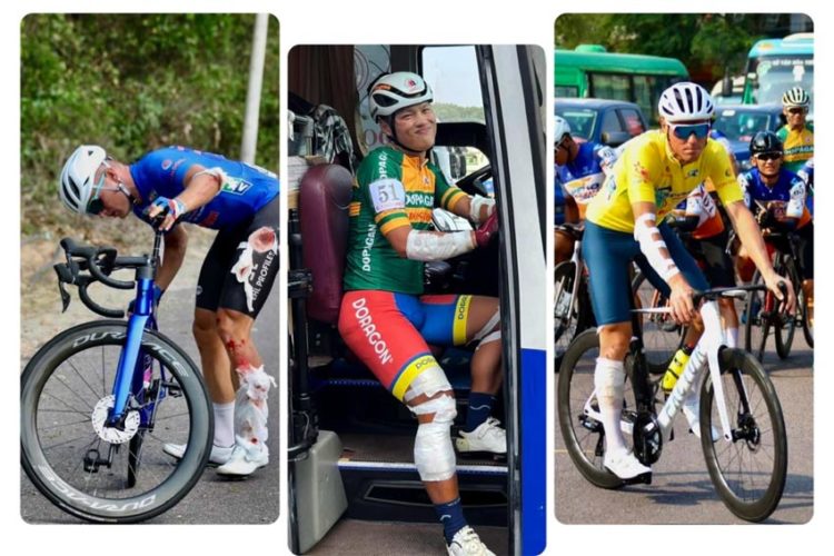 Áo vàng Petr Rikunov chiến binh dũng mãnh bất chấp chấn thương - 14