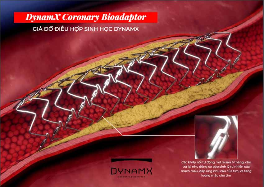Hội nghị tim mạch Châu Âu công bố kết quả nghiên cứu Dynamx Bioadaptor - 3